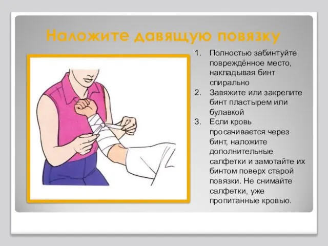 Наложите давящую повязку Полностью забинтуйте повреждённое место, накладывая бинт спирально Завяжите или