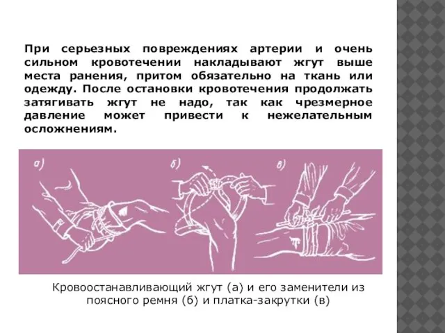 При серьезных повреждениях артерии и очень сильном кровотечении накладывают жгут выше места