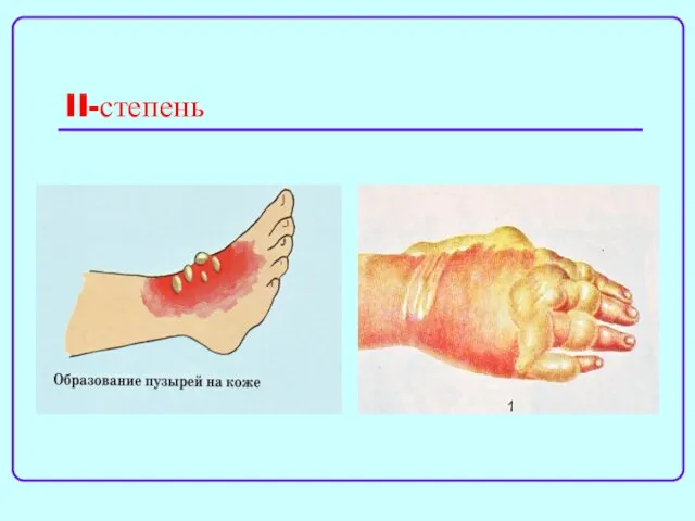 II-степень