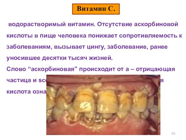 водорастворимый витамин. Отсутствие аскорбиновой кислоты в пище человека понижает сопротивляемость к заболеваниям,