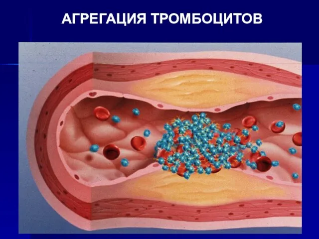 АГРЕГАЦИЯ ТРОМБОЦИТОВ