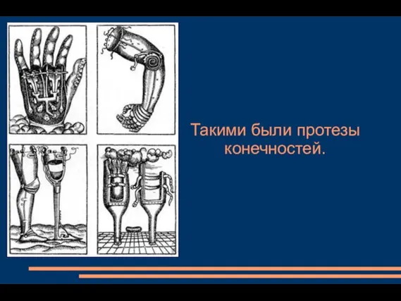 Такими были протезы конечностей.