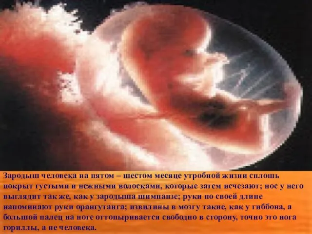 Зародыш человека на пятом – шестом месяце утробной жизни сплошь покрыт густыми