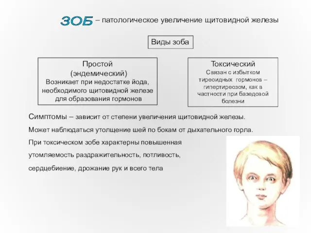 – патологическое увеличение щитовидной железы Простой (эндемический) Возникает при недостатке йода, необходимого