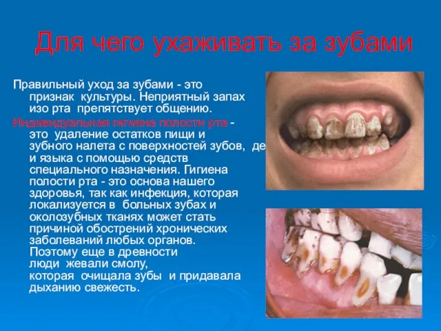 Для чего ухаживать за зубами Правильный уход за зубами - это признак