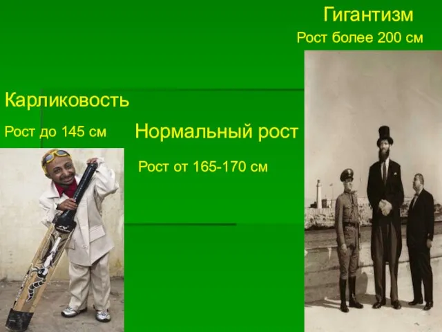 Нормальный рост Карликовость Гигантизм Рост до 145 см Рост от 165-170 см Рост более 200 см