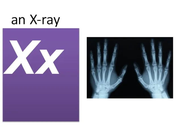 an X-ray Xx