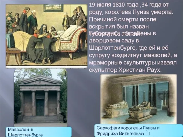 19 июля 1810 года ,34 года от роду, королева Луиза умерла. Причиной