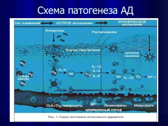 Схема патогенеза АД