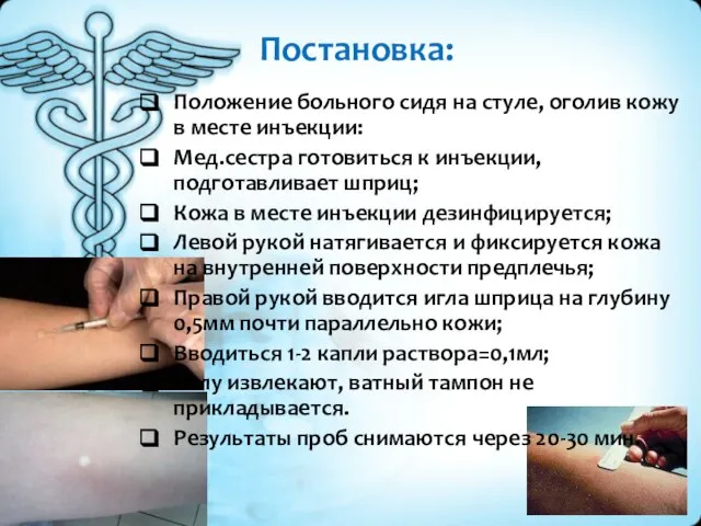 Постановка: Положение больного сидя на стуле, оголив кожу в месте инъекции: Мед.сестра