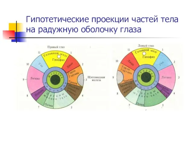 Гипотетические проекции частей тела на радужную оболочку глаза