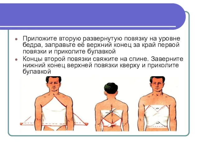 Приложите вторую развернутую повязку на уровне бедра, заправьте её верхний конец за