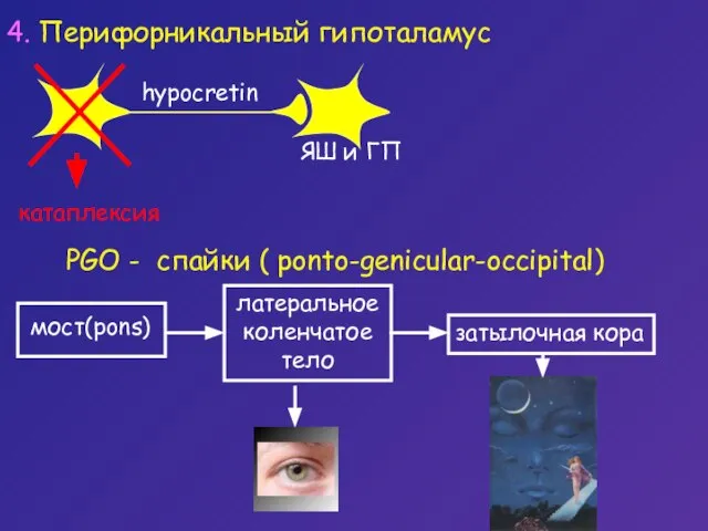 PGO - спайки ( ponto-genicular-occipital) латеральное коленчатое тело затылочная кора 4. Перифорникальный гипоталамус катаплексия