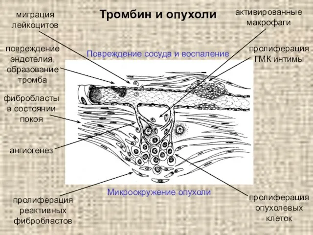 Тромбин и опухоли