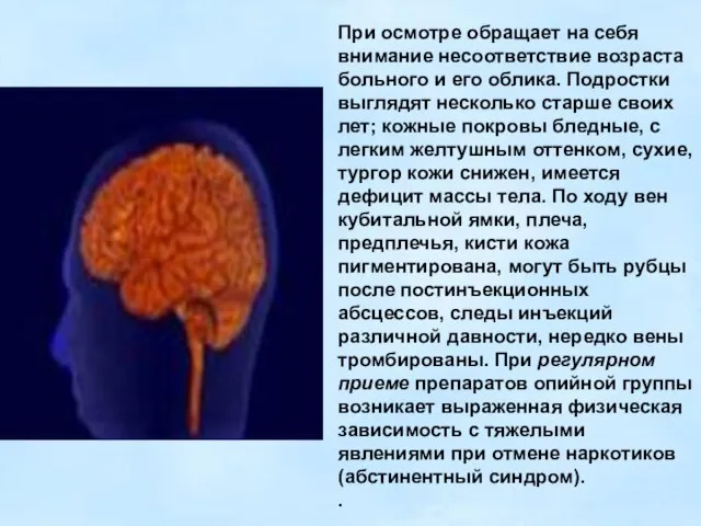 При осмотре обращает на себя внимание несоответствие возраста больного и его облика.