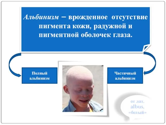 Полный альбинизм Частичный альбинизм Альбинизм – врожденное отсутствие пигмента кожи, радужной и