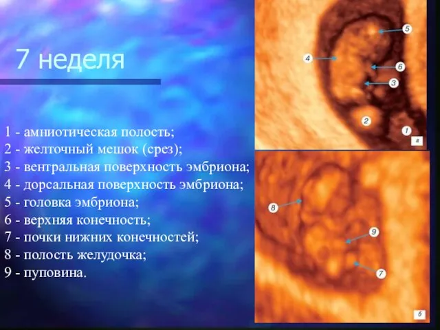 1 - амниотическая полость; 2 - желточный мешок (срез); 3 - вентральная