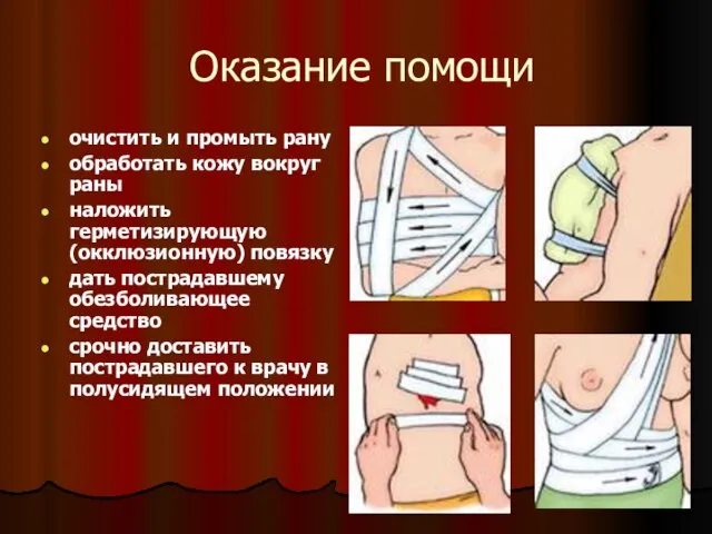 Оказание помощи очистить и промыть рану обработать кожу вокруг раны наложить герметизирующую