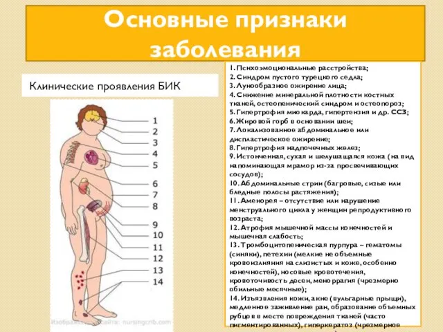 Основные признаки заболевания Клинические проявления БИК 1. Психоэмоциональные расстройства; 2. Синдром пустого