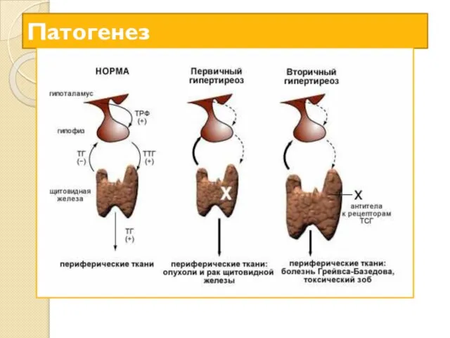 Патогенез