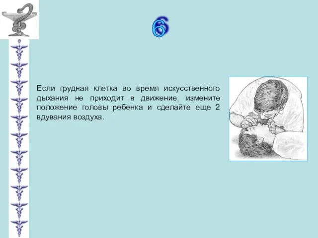 6 Если грудная клетка во время искусственного дыхания не приходит в движение,