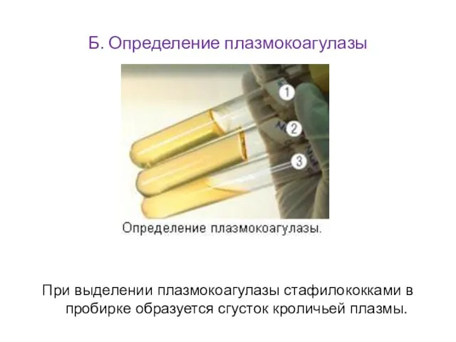 Б. Определение плазмокоагулазы При выделении плазмокоагулазы стафилококками в пробирке образуется сгусток кроличьей плазмы.