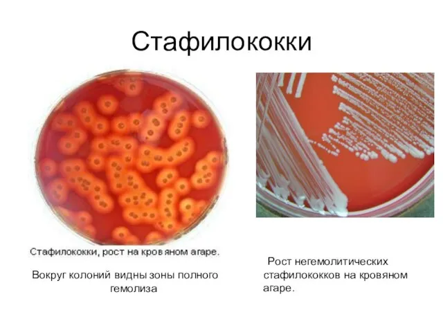 Стафилококки Вокруг колоний видны зоны полного гемолиза Рост негемолитических стафилококков на кровяном агаре.