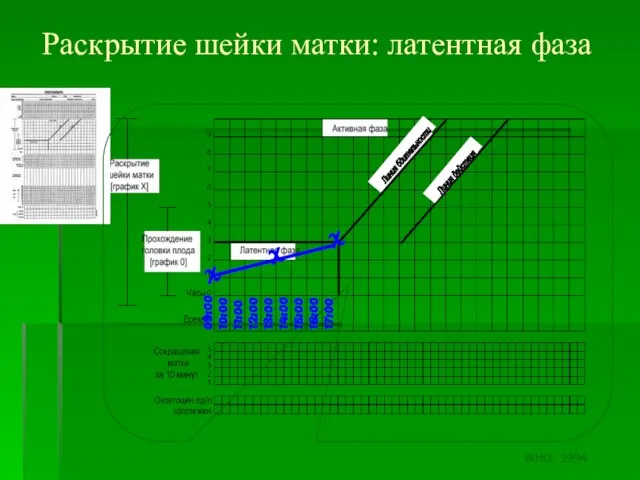 Раскрытие шейки матки: латентная фаза 09:00 10:00 11:00 12:00 13:00 14:00 15:00