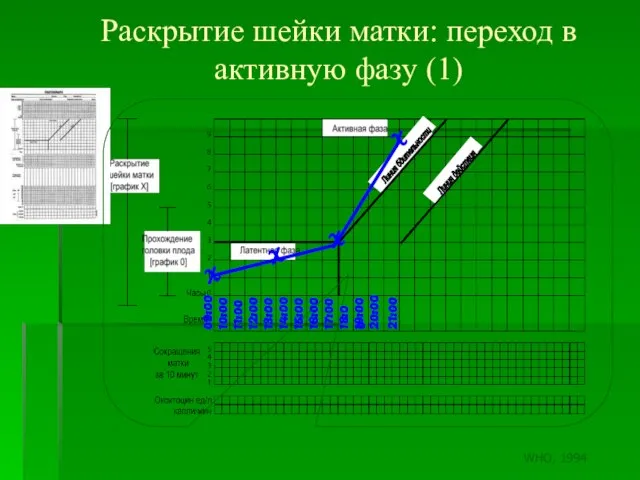 Раскрытие шейки матки: переход в активную фазу (1) 09:00 10:00 11:00 12:00