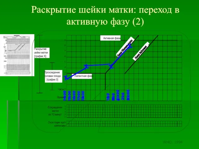 Раскрытие шейки матки: переход в активную фазу (2) 14:00 15:00 16:00 17:00