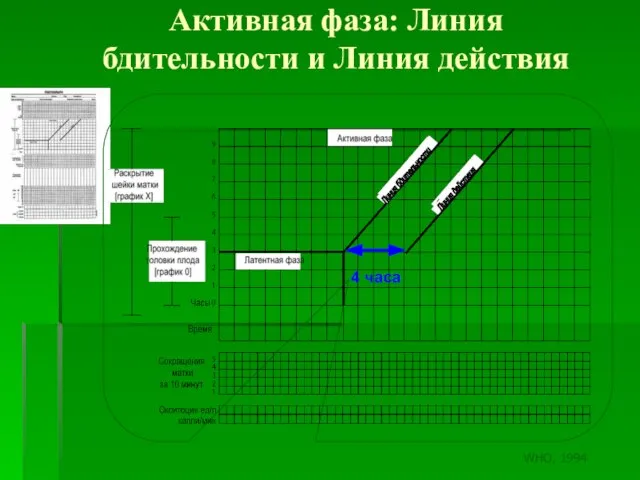 Активная фаза: Линия бдительности и Линия действия Линия бдительности Линия действия 4 часа WHO, 1994