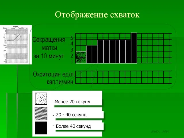 Отображение схваток Менее 20 секунд 20 - 40 секунд Более 40 секунд WHO, 1994