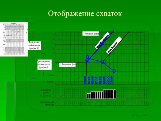 Отображение схваток 14:00 15:00 16:00 17:00 18:00 19:00 20:00 21:00 O O