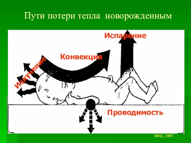 Излучение Конвекция Испарение Проводимость Пути потери тепла новорожденным WHO, 1997