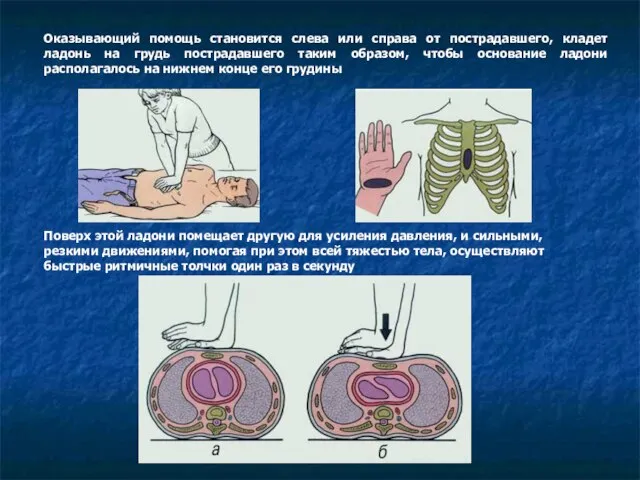 Оказывающий помощь становится слева или справа от пострадавшего, кладет ладонь на грудь