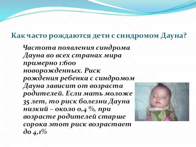 Как часто рождаются дети с синдромом Дауна? Частота появления синдрома Дауна во