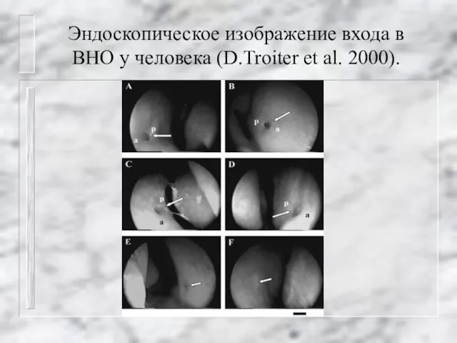 Эндоскопическое изображение входа в ВНО у человека (D.Troiter et al. 2000).