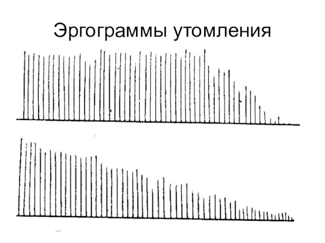 Эргограммы утомления