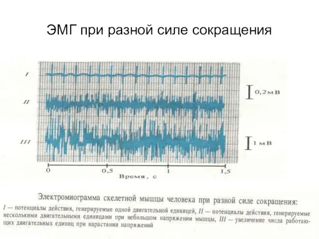 ЭМГ при разной силе сокращения