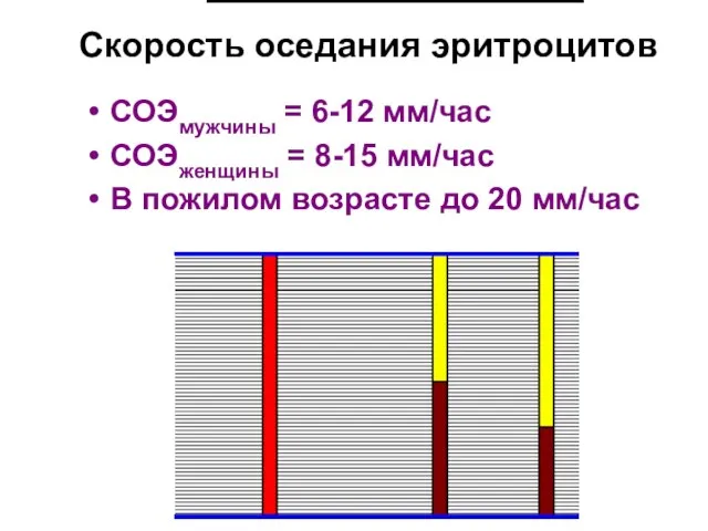 Скорость оседания эритроцитов СОЭмужчины = 6-12 мм/час СОЭженщины = 8-15 мм/час В