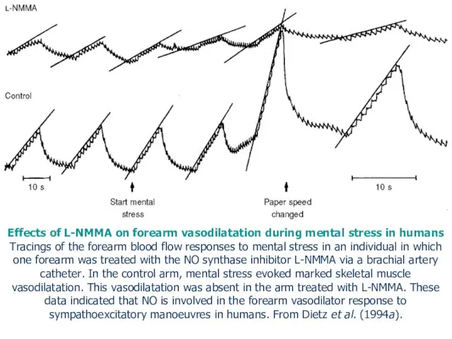 Effects of L-NMMA on forearm vasodilatation during mental stress in humans Tracings