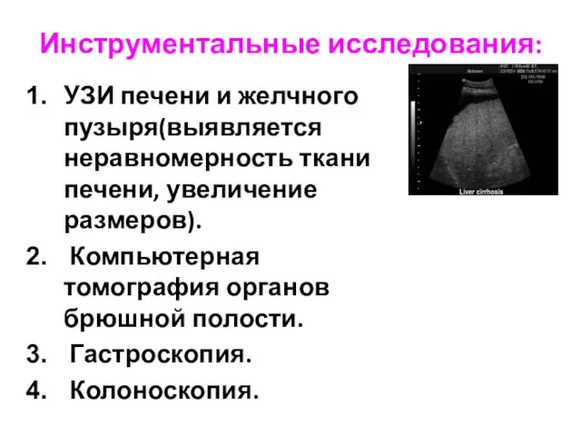 Инструментальные исследования: УЗИ печени и желчного пузыря(выявляется неравномерность ткани печени, увеличение размеров).