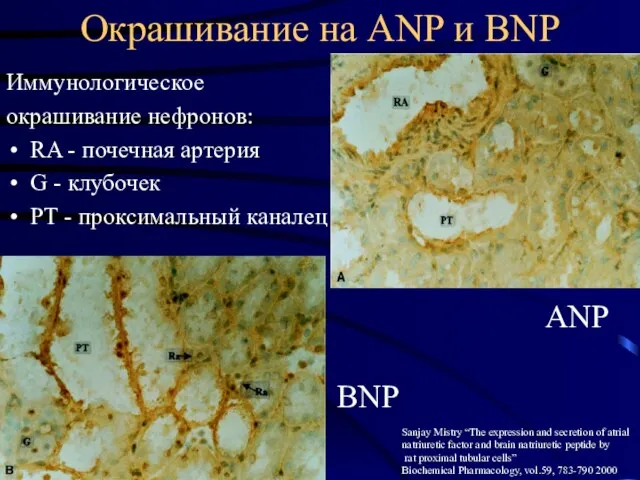 Окрашивание на ANP и BNP Иммунологическое окрашивание нефронов: RA - почечная артерия