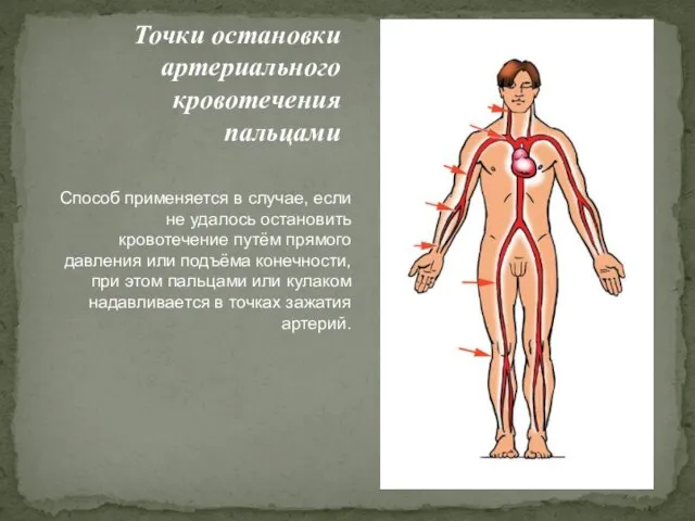 Точки остановки артериального кровотечения пальцами Способ применяется в случае, если не удалось