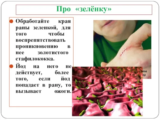 Про «зелёнку» Обработайте края раны зеленкой, для того чтобы воспрепятствовать проникновению в