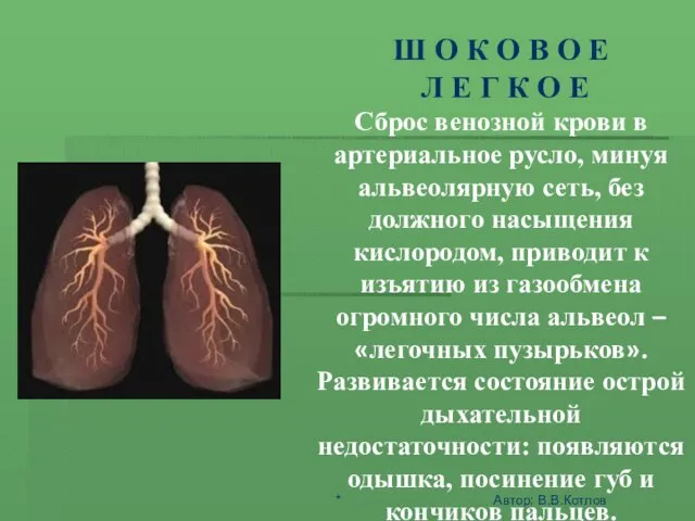 ШОК - ЭТО АКТИВНАЯ ЗАЩИТА ОРГАНИЗМА ОТ АГРЕССИИ СРЕДЫ Ш О К