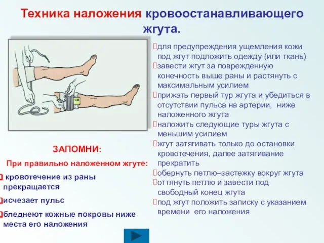 для предупреждения ущемления кожи под жгут подложить одежду (или ткань) завести жгут