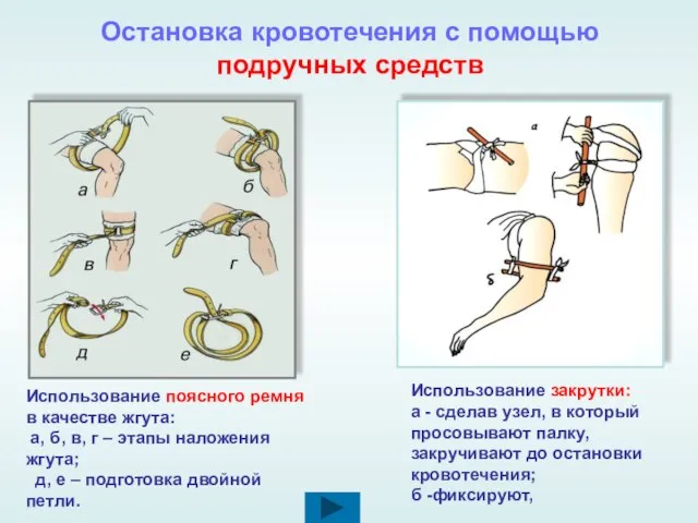 Остановка кровотечения с помощью подручных средств Использование поясного ремня в качестве жгута: