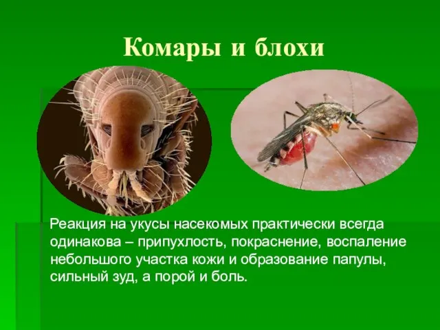 Комары и блохи Реакция на укусы насекомых практически всегда одинакова – припухлость,