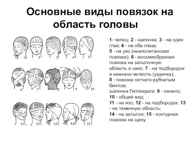Основные виды повязок на область головы 1- чепец; 2 - шапочка; 3
